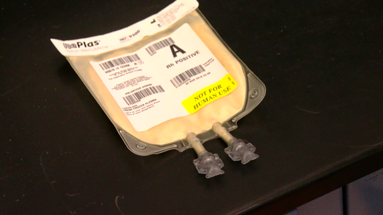 New freezedried plasma could be used to help the military KTVO