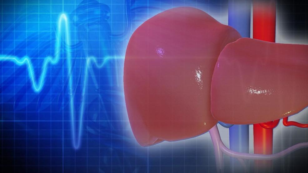 understanding-how-to-detect-live-with-fatty-liver-disease-woai