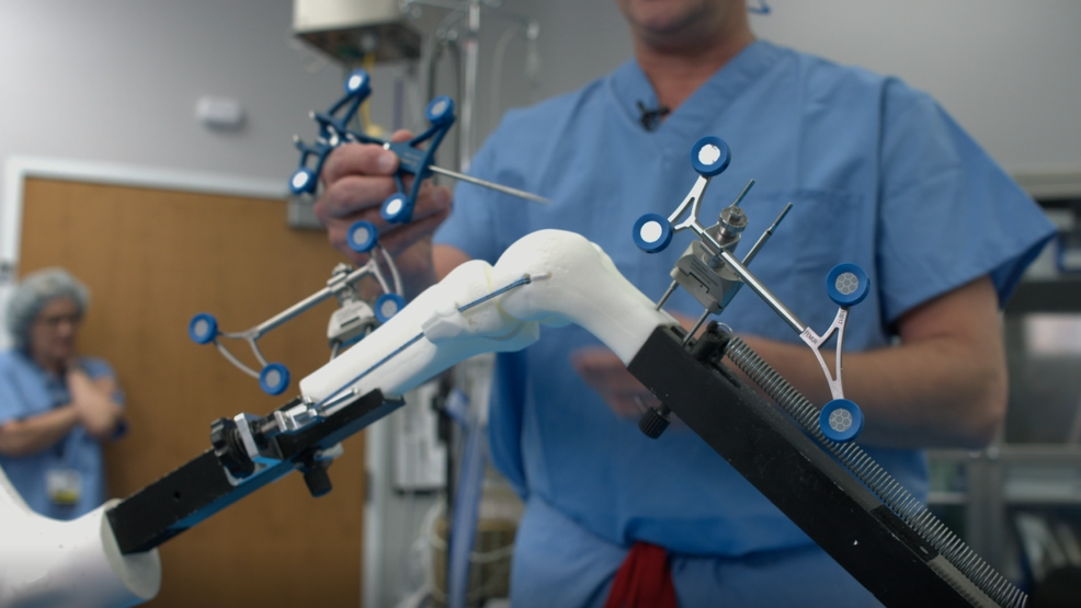 LewisGale Using Robotics-assisted Knee Surgery | WSET